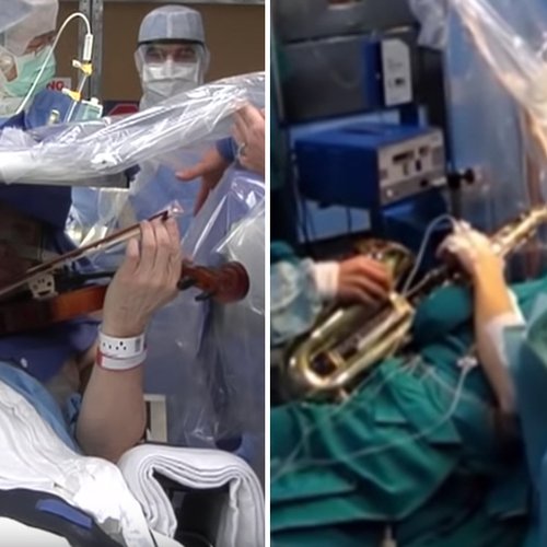 Musicians - brain surgery